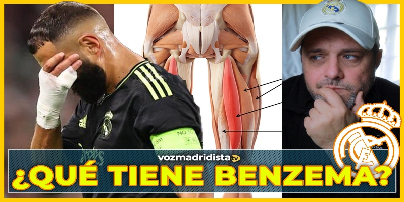 VÍDEO | ¿Qué tiene Benzema?